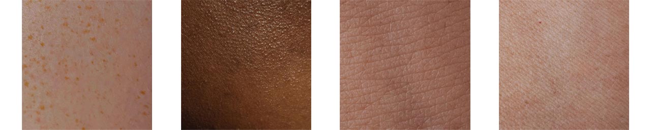 Hauttypen - normale Haut - trockene Haut - fettige Haut - Mischhaut